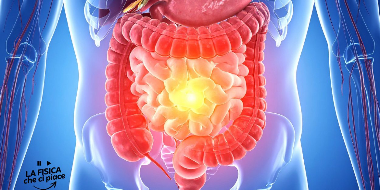 Sempre più giovani hanno il cancro al colon: i medici lanciano l'allarme