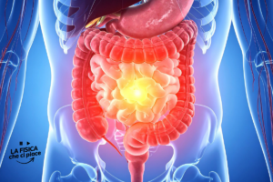 Sempre più giovani hanno il cancro al colon: i medici lanciano l'allarme